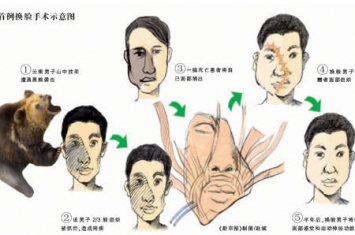 换脸手术真的存在吗