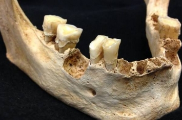 英国考古学家发现6000年前的新石器时代人类或许已将奶类加工减乳糖不耐症影响