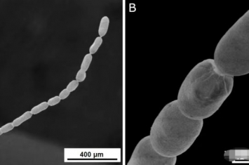 最大细菌华丽念珠菌图片