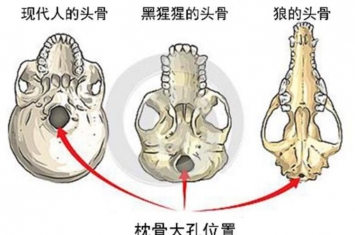 埃塞俄比亚人类化石,埃塞俄比亚的考古