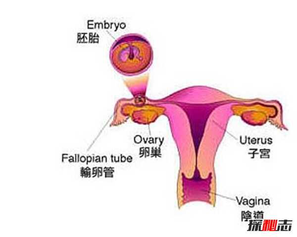 天狗是什么?为什么会有天狗吞月的现象(太阳月球地球同一直线上)