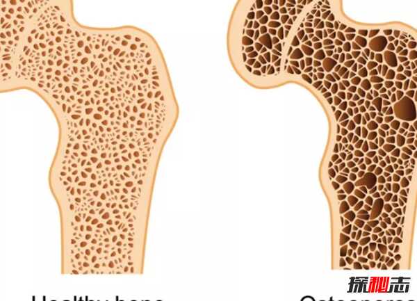 人骨为什么那么可怕?人体骨骼的十大疯狂事实