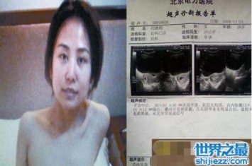 容城艾滋女事件，&quot;艾滋女&quot;闫德利并无艾滋(被诬陷) ...