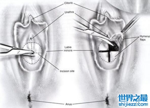 石女是什么意思，石女是指先天无法进行性行为的女性