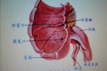 阑尾一定要割掉吗?阑尾切除的坏处