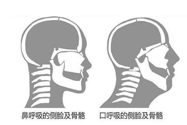 为什么用嘴巴呼吸不健康?易细菌感染血氧不足(影响颜值)