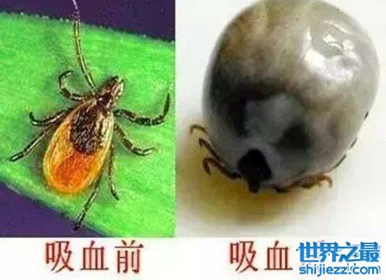 可怕！蜱虫叮咬后伤口图片竟是这样，咬伤后必须恰当处理！ ...