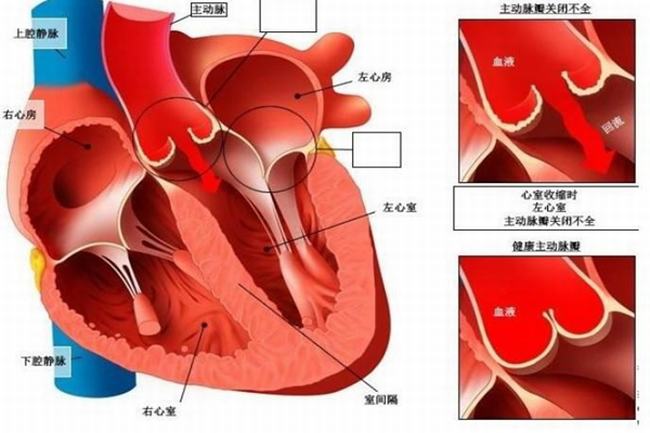 胆小和胆有关系吗?胆囊是储存胆汁的器官(和胆小无关)