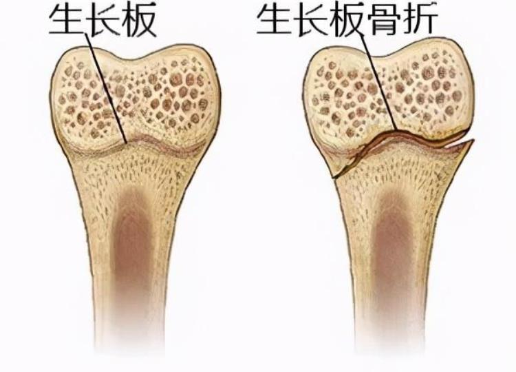 打篮球可以长高,矮个子打篮球能长高吗