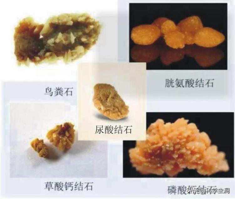 火化出舍利子是成佛了吗,舍利真正形成的原因