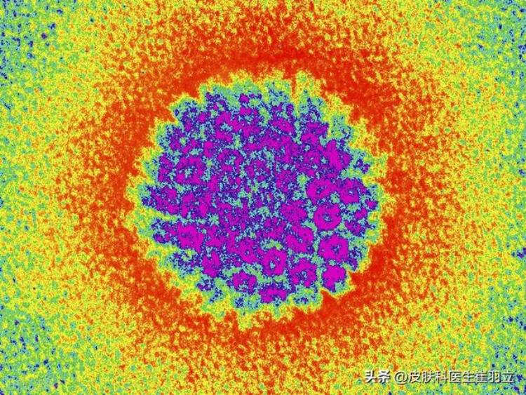 hpv16型阳性做了锥切后还是阳性,锥切3个月后hpv16还是阳性