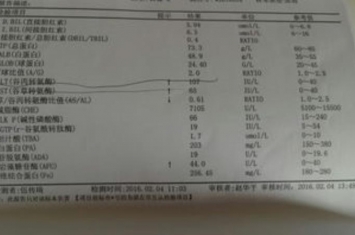 肝功能正常小三阳病毒不复制的老人为什么要抗病毒治疗,50岁小三阳就该抗病毒治疗吗