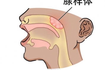 病毒性感冒吃抗生素没用,抗生素对细菌有用还是对病毒有用