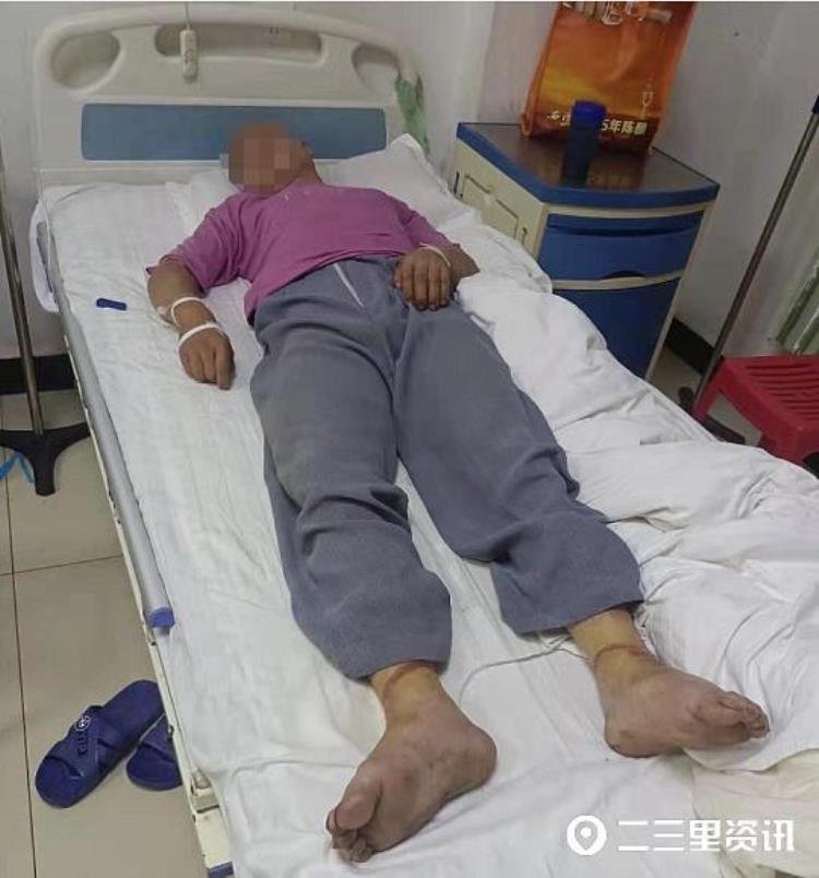 一男子被发现吊死在家中,男子发现自己醒来被吊在树上