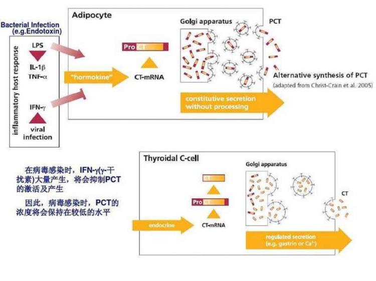 细菌感染和病毒感染怎么样鉴别三甲医生的经验