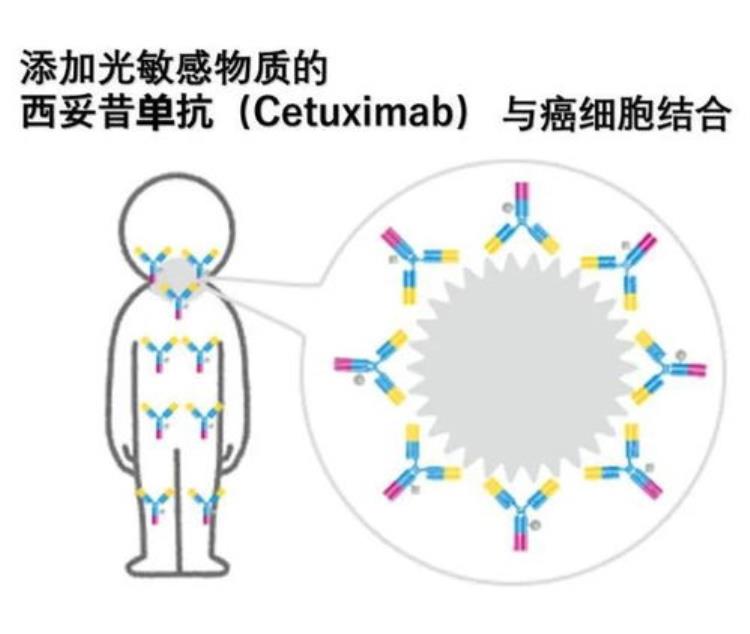 免疫治疗会有什么不良反应,化疗3天后有什么反应