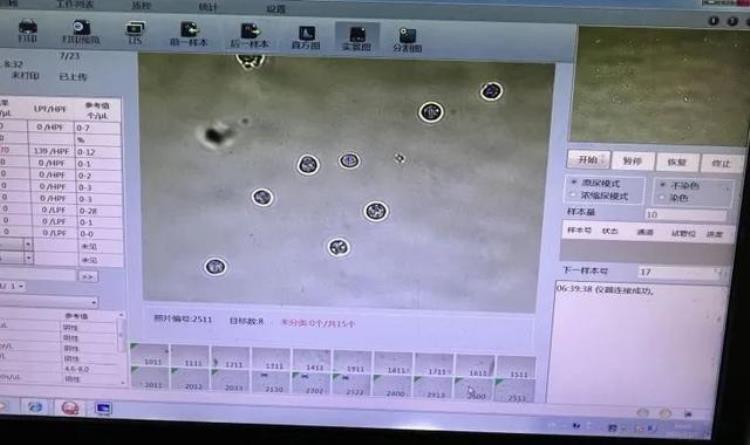 怀疑泌尿系感染应该做哪些检查呢,怀疑肾炎做什么检查