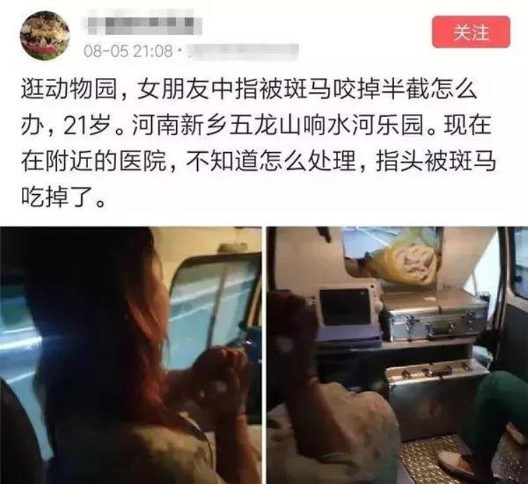 女子被斑马咬手指,斑马咬掉半边脸