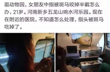 女子被斑马咬手指,斑马咬掉半边脸