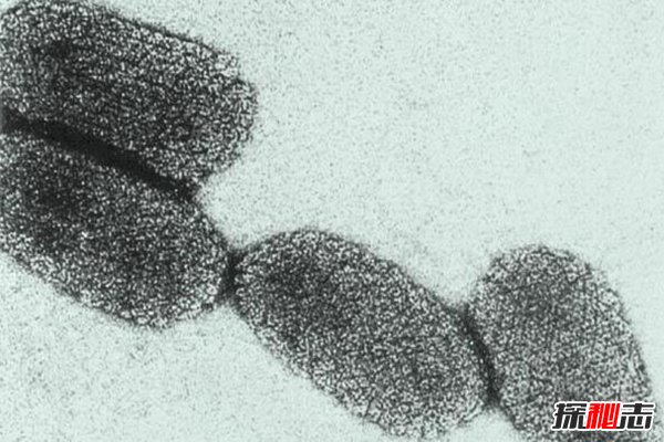 世界十大恐怖病毒 埃博拉可让活人融化惊悚至极