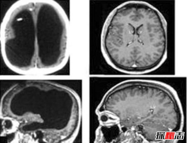 吃薯片致癌是真的吗?薯片的10大好处和坏处(真相揭秘)