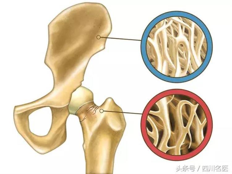 致残的因素,我国致死致残率第一的疾病